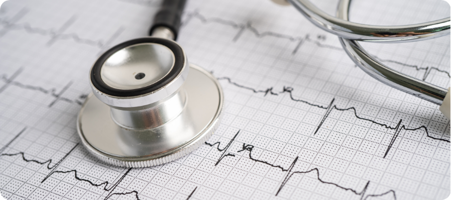 ECG