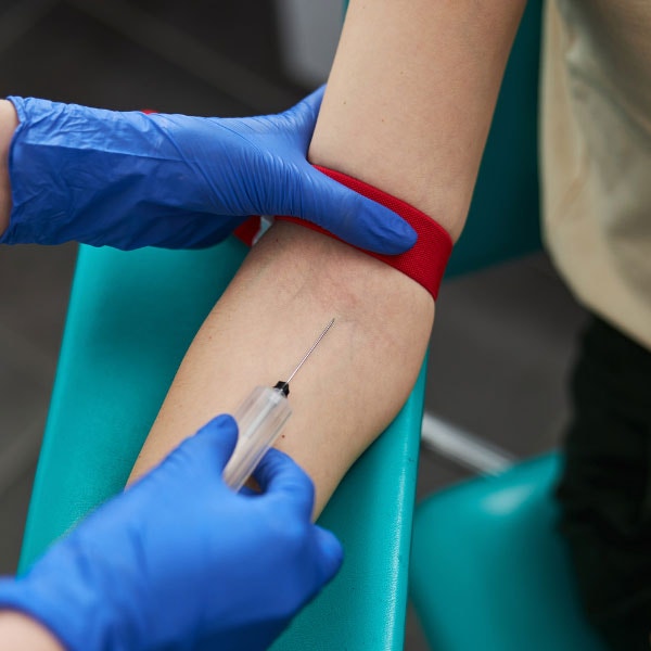 7 réflexes à adopter au quotidien lorsqu'on a du cholestérol